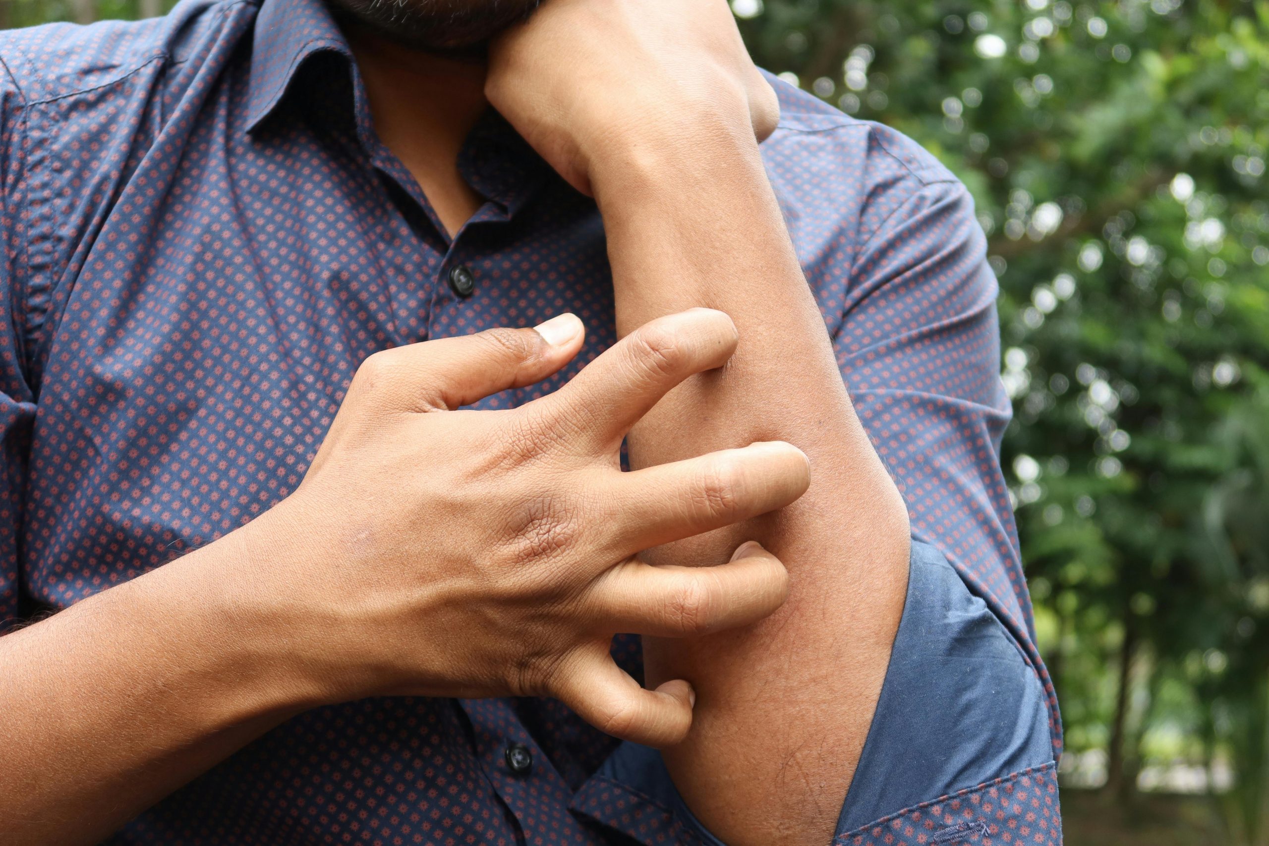 man scratching his forearm